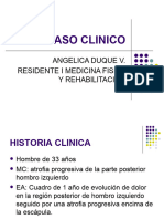 Caso Clinico Neuropatias Proximales MS