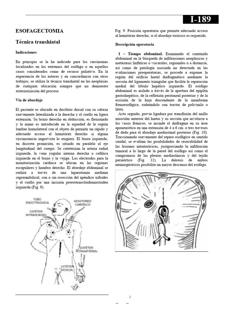 Técnicas de esofagectomía transhiatal | PDF | Estómago | Anatomía