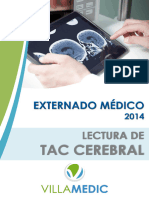 Tac Cerebral Normal y Patológica