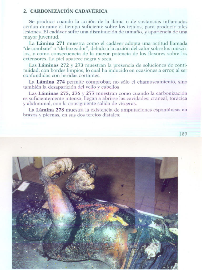 Carbonización cadavérica y sus efectos | PDF | Química | Medicina CLINICA