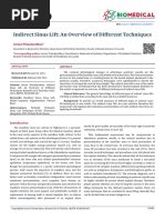 Indirect Sinus Lift - Review