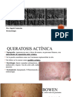 Lesiones Precancerosas Epiteliales y Neoplasicas