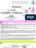 Tomografia Computarizada