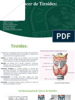 Cáncer de Tiroides