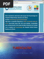 tuberculose