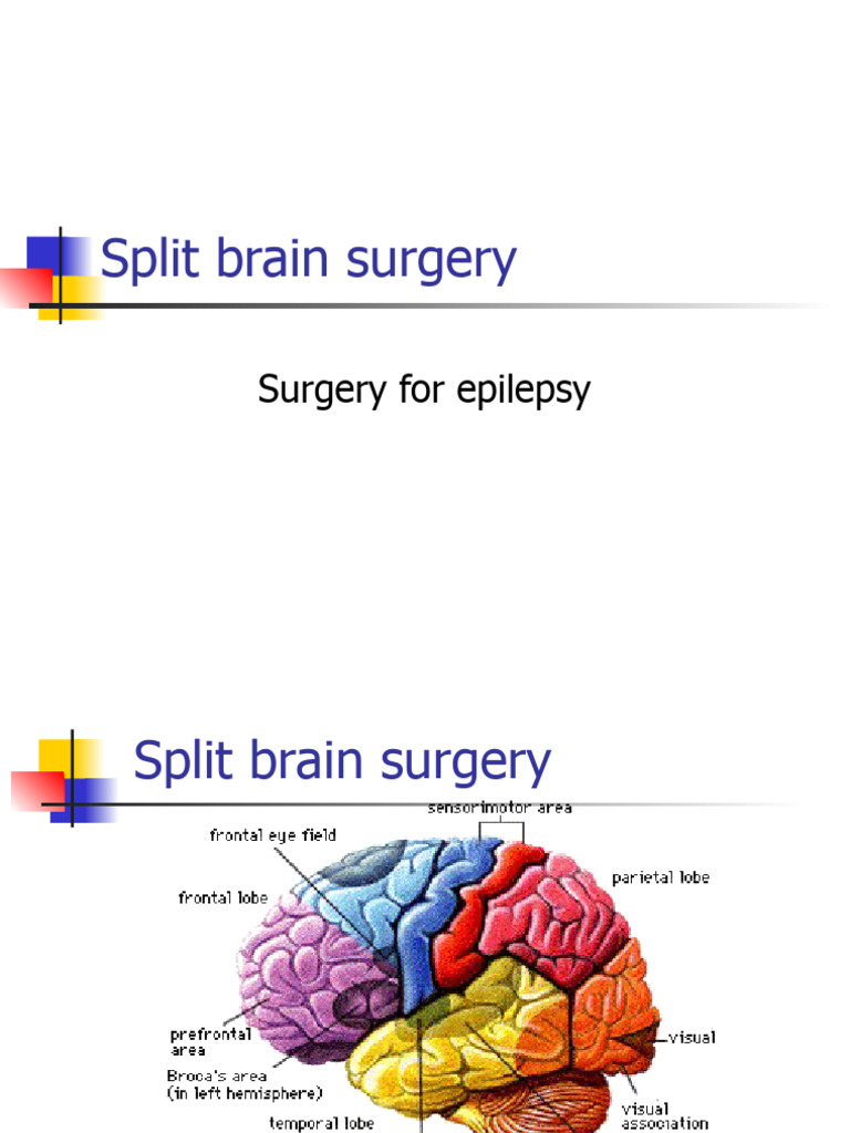 Split Brain Surgery | PDF | Cerebral Hemisphere | Lateralization Of