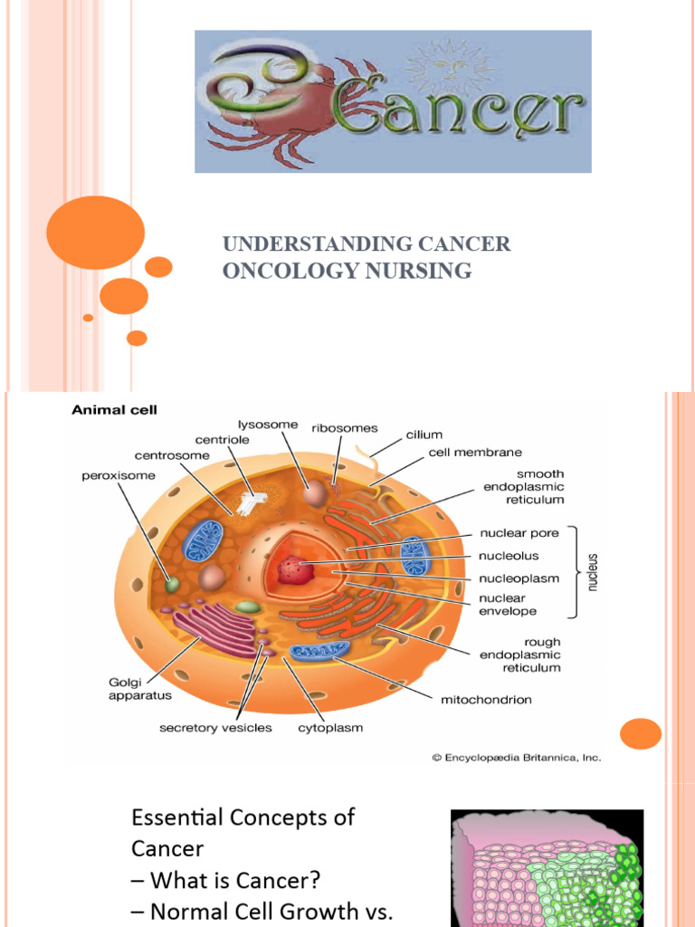 Advanced Pathophysiology Testicular Cancer Lecture