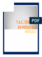 Protocolo Tac Pediatria