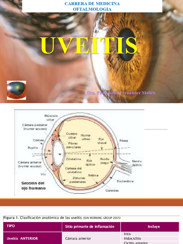 Uveitis: Tipos, Diagnóstico y Tratamiento | PDF | Inflamación | Virus