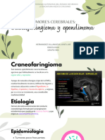 Craneofaringioma y Ependimoma