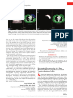 Microsurgical Reconstruction of A Huge Mediastinal Defect Using Thoracoacromial Vessels As Recipient Pedicle