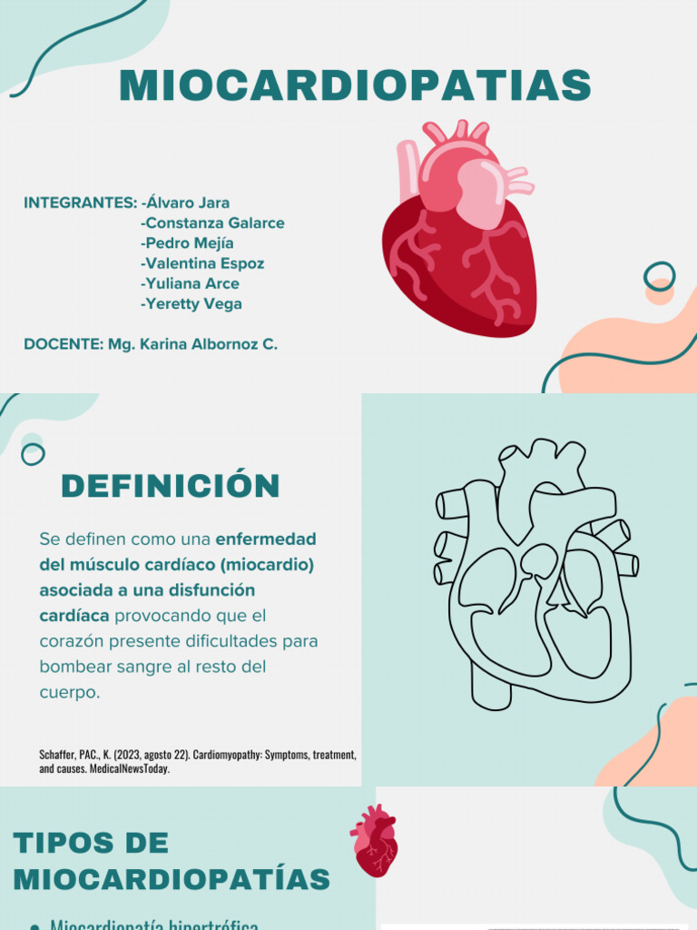 Miocardiopatías PDF