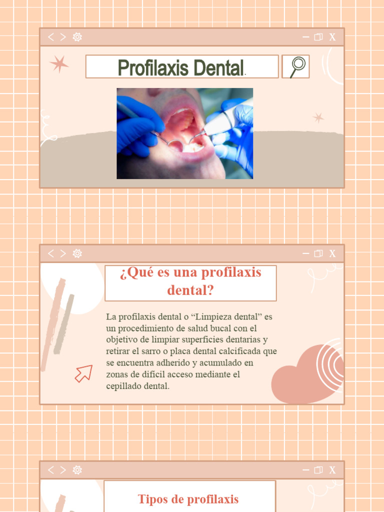 Tipos y Protocolo de Profilaxis Dental | PDF | Ramas de Odontología ...