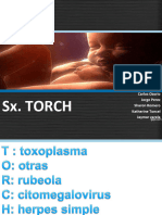 Sxtorch 130213184825 Phpapp01