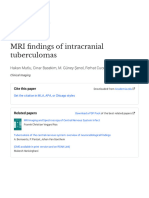 MRI - Findings - of - Intracranial - Tuberculoma20160113 31505 1iyy7oo - pdf20160115 19908 1gzynfp With Cover Page v2