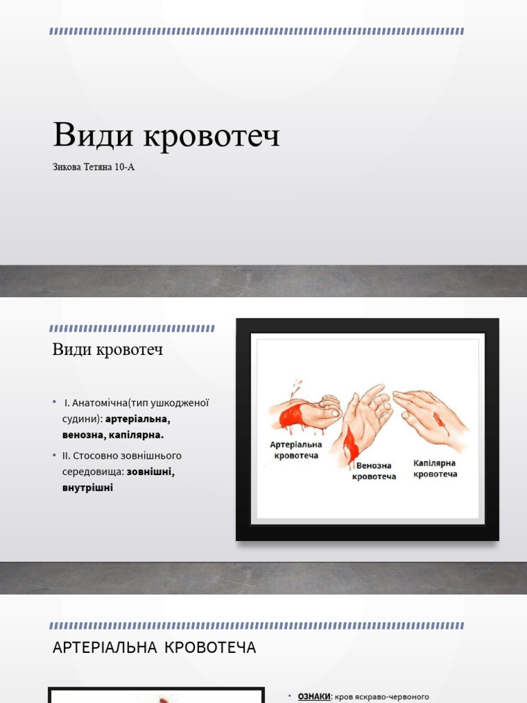 Види кровотеч | PDF