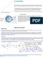 Visual Defects