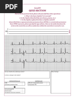Rhythm Diagnosis Cheat Sheet | PDF