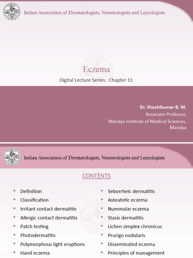 Eczema | PDF | Dermatitis | Allergy