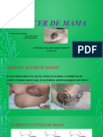 Diapositiva Cancer de Mama