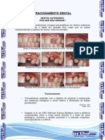 13-Procedimentos Peridontais Auxiliares Da Orto