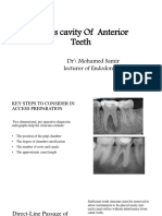 4 - Access Cavity of Anterior Teeth 2022