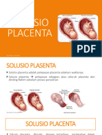 Solusio Placenta