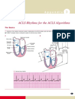 ECG Rhythms for ACLS