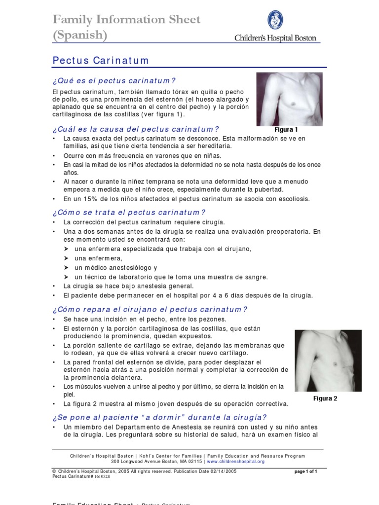 pectus carinatum Surgery Anesthesia