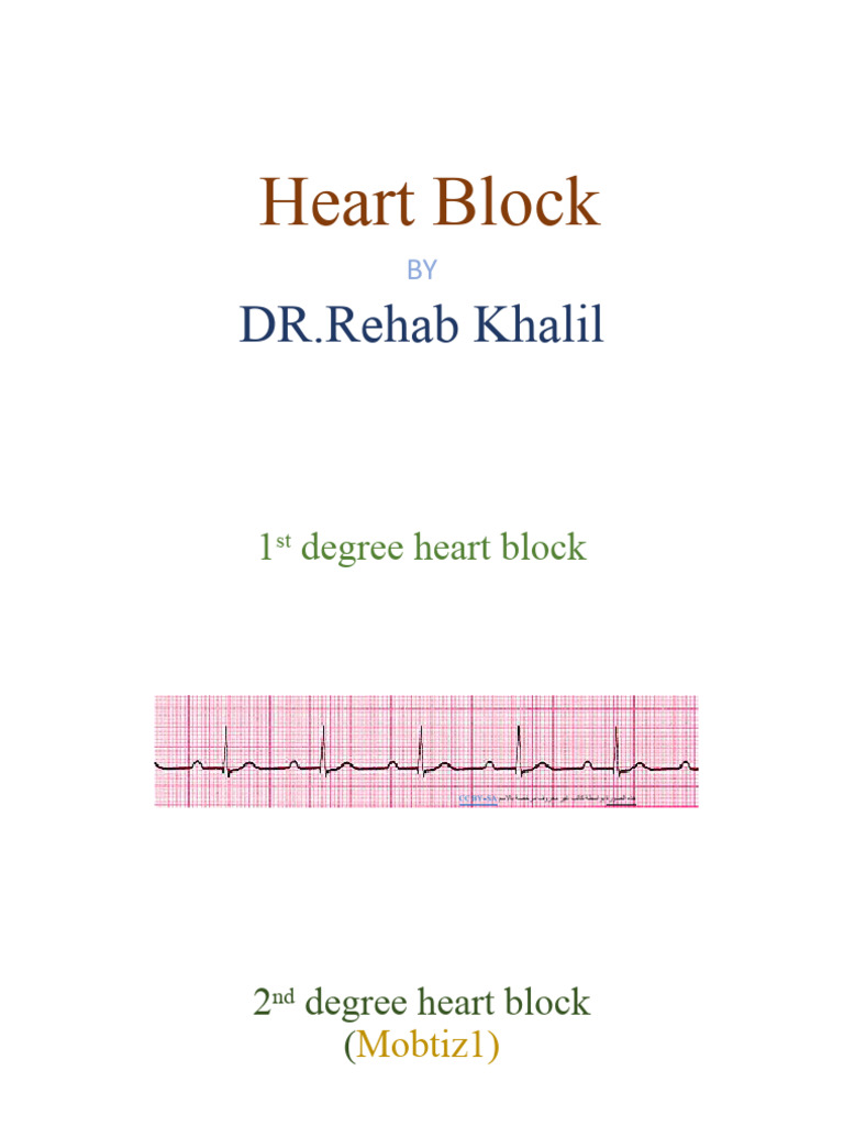 Heart Block PDF