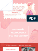 NEUMONÍAS, ATELECTASIA, DERRAME PLEURAL, Ic CONGESTIVA Y EDEMA PULMONAR