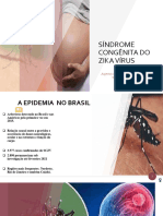 Síndrome Congênita Do Zika Vírus