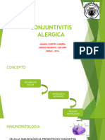 Conjuntivitis Alergica2