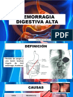 Hemorragia Digestiva Alta