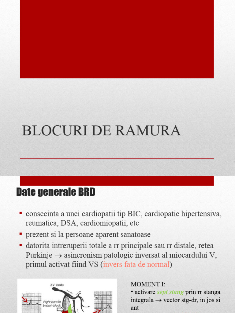Ekg BRD - BRS Iv | PDF