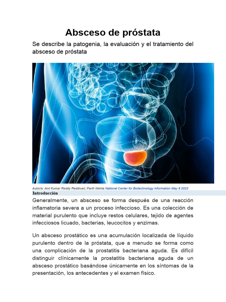 Absceso Prostático: Diagnóstico y Tratamiento | PDF | Cancer de ...