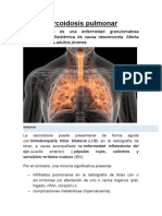 Sarcoidosis Pulmonar