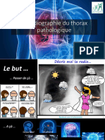 La Radiographie Du Thorax Pathologique RD 2021 PDF