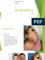 Ameloblastoma PDF