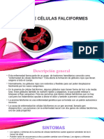 Anemia de Células Falciformes 2