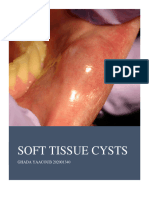 Cysts of The Oral Cavity