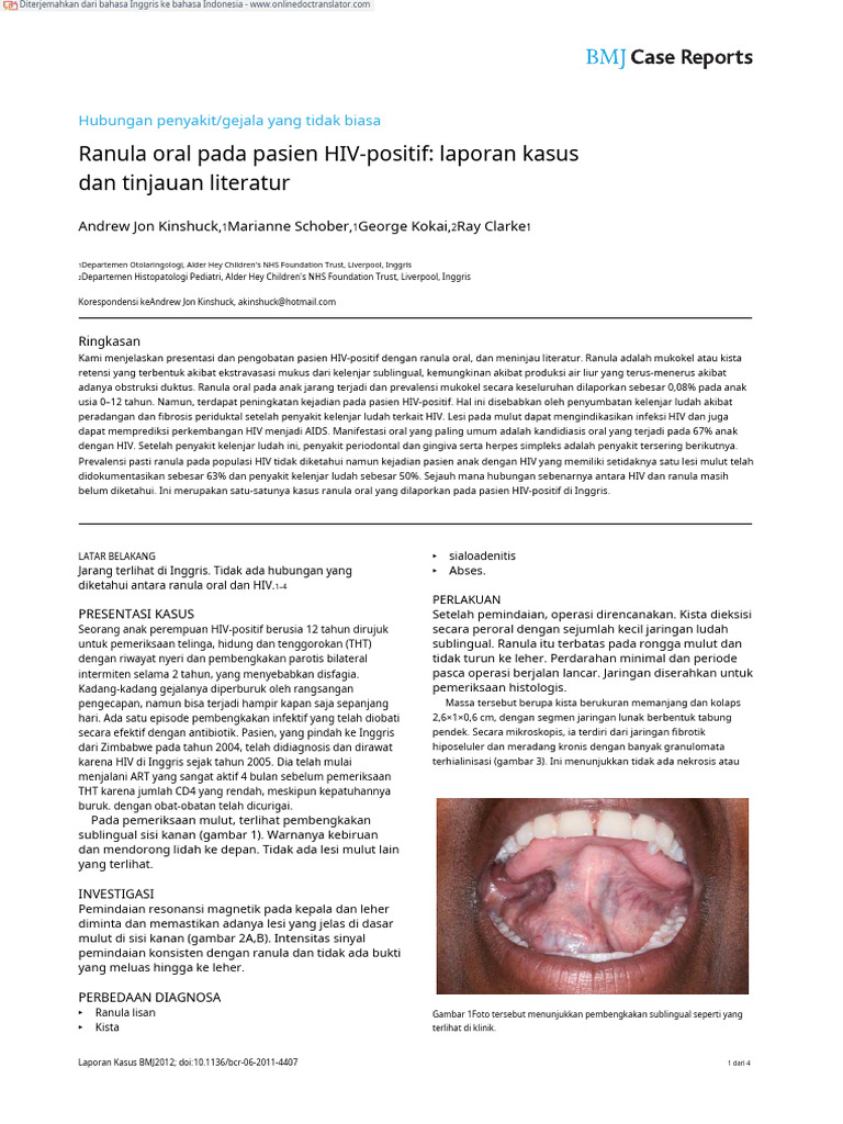 Ranula Oral pada Pasien HIV-Positif | PDF