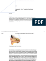 Audiology Online Fitting CI