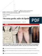 Noticia Lipedema El Mostrador