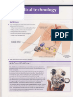 Switch On: Artificial Heart Mechanism