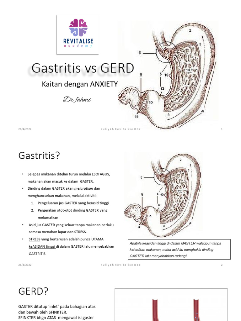 Perbandingan Gastritis dan GERD | PDF