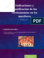 TEMA 13 - Indicaciones y Planificación de Las Corticotomías de Los Maxilares
