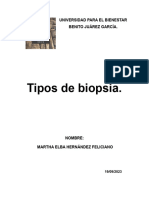 Tipos de Biopsia