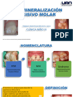 Hipomineralización Inciso Molar