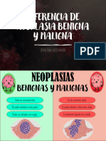 Diferencia de Neoplasia Benigna y Maligna